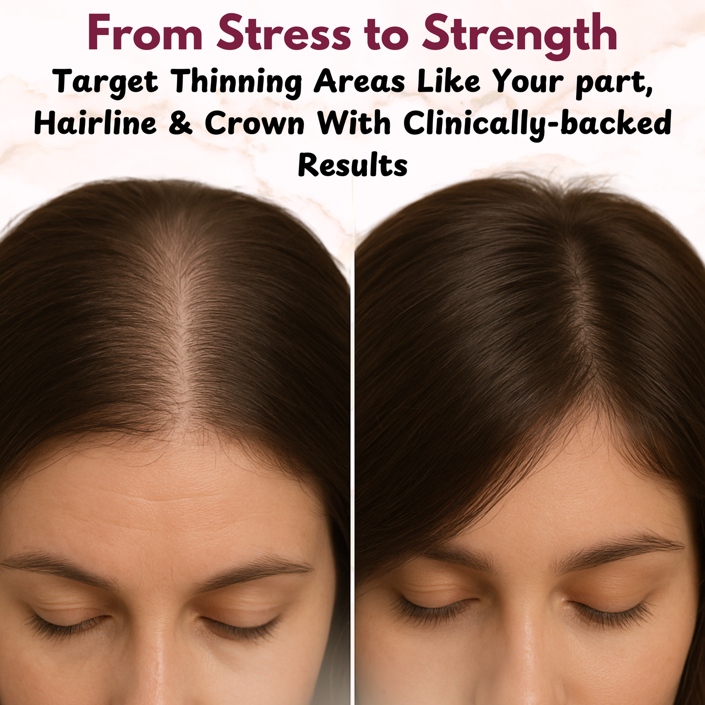 GROWLUX Hair Growth & Scalp Ritual Set - LUXEVA