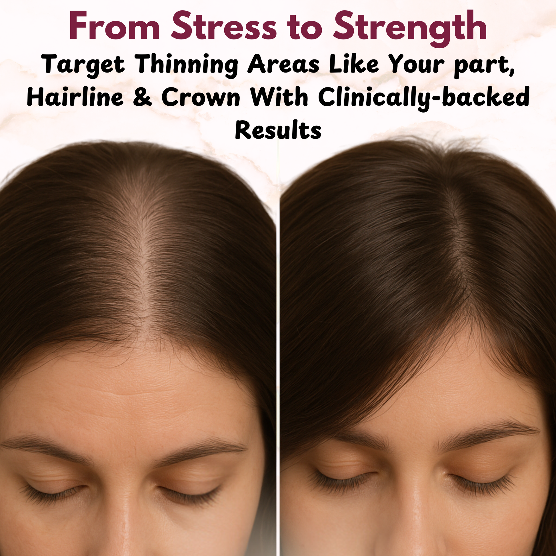 GROWLUX Hair Growth & Scalp Ritual Set - LUXEVA